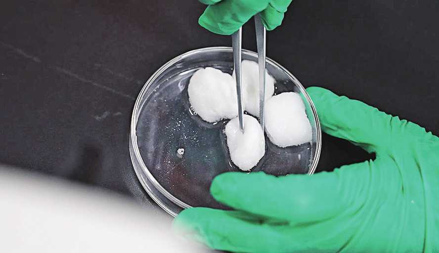 保持心情愉悦能避免子宫癌吗？子宫癌的三大主因是这些