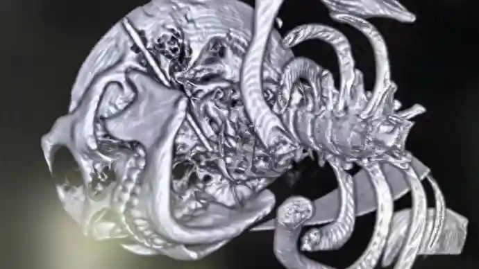 29岁男子酒后争执出现意外，筷子贯穿耳颈咽喉命悬一线，九院团队险中夺生机