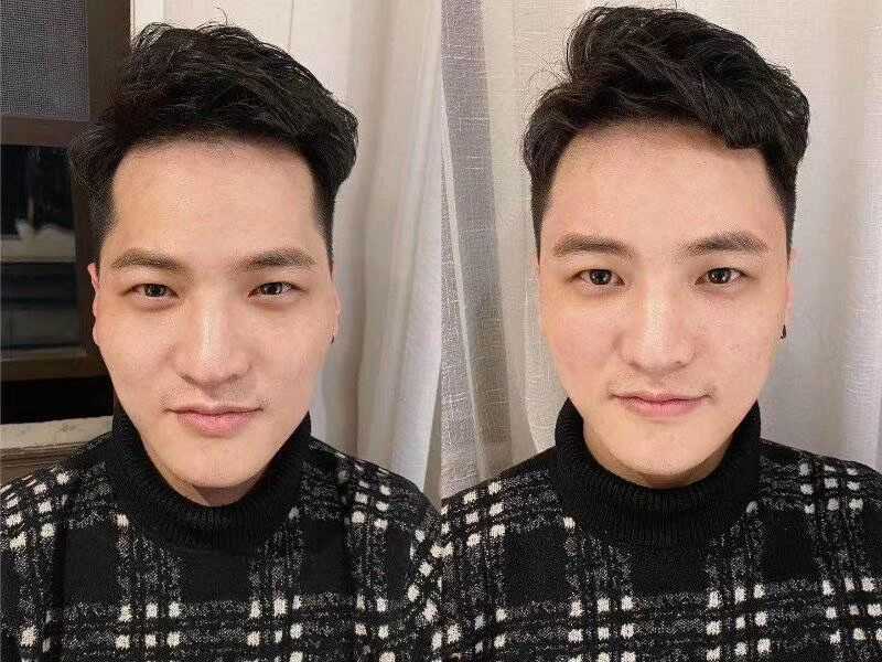 秋天是脱发高峰 最新科学成果可能彻底解决这个问题