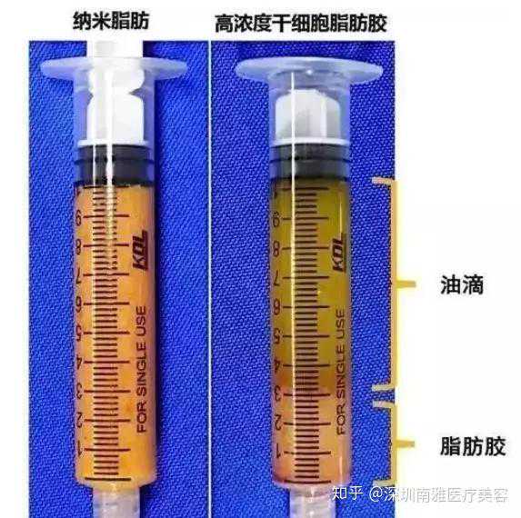 2020ASH 大咖解读 | 金洁教授：新诊断多发性骨髓瘤的前沿进展