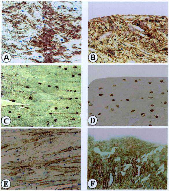 36岁暖心“叔叔”捐献造血干细胞救10岁白血病患儿