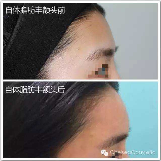 爱心让生命延续——记酒泉造血干细胞捐献第一人瓜州县公安辅警王旭