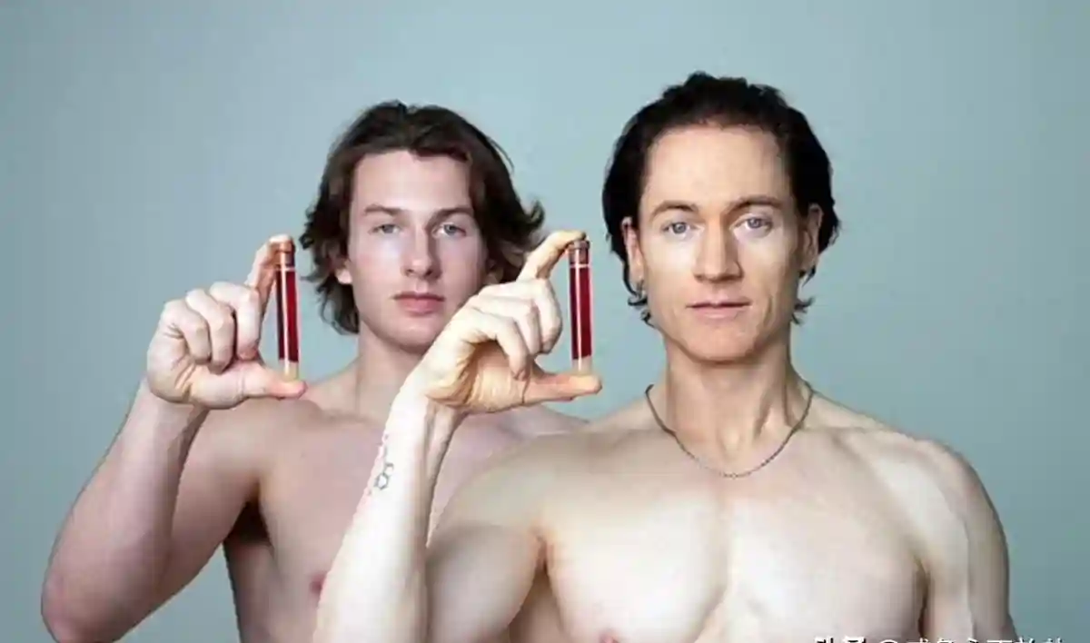 47岁美国亿万富豪换血回春，注射他人脂肪“面目全非”致暂时失明